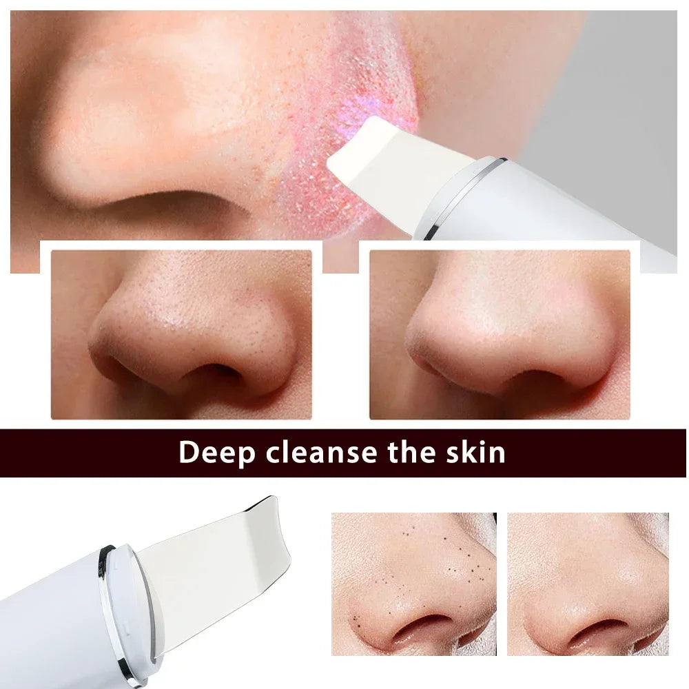 Ultrasonic Skin Scrubber Peeling Blackhead Remover Deep Face Cleaning Ultrasonic Ion Acne Pore Cleaner Facial Shovel Scrubber